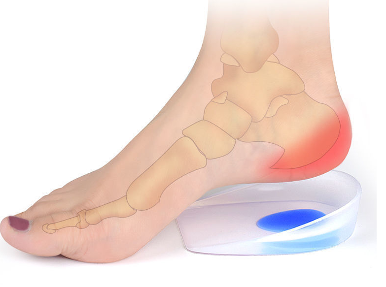 Silicone Heel Pad Reliever