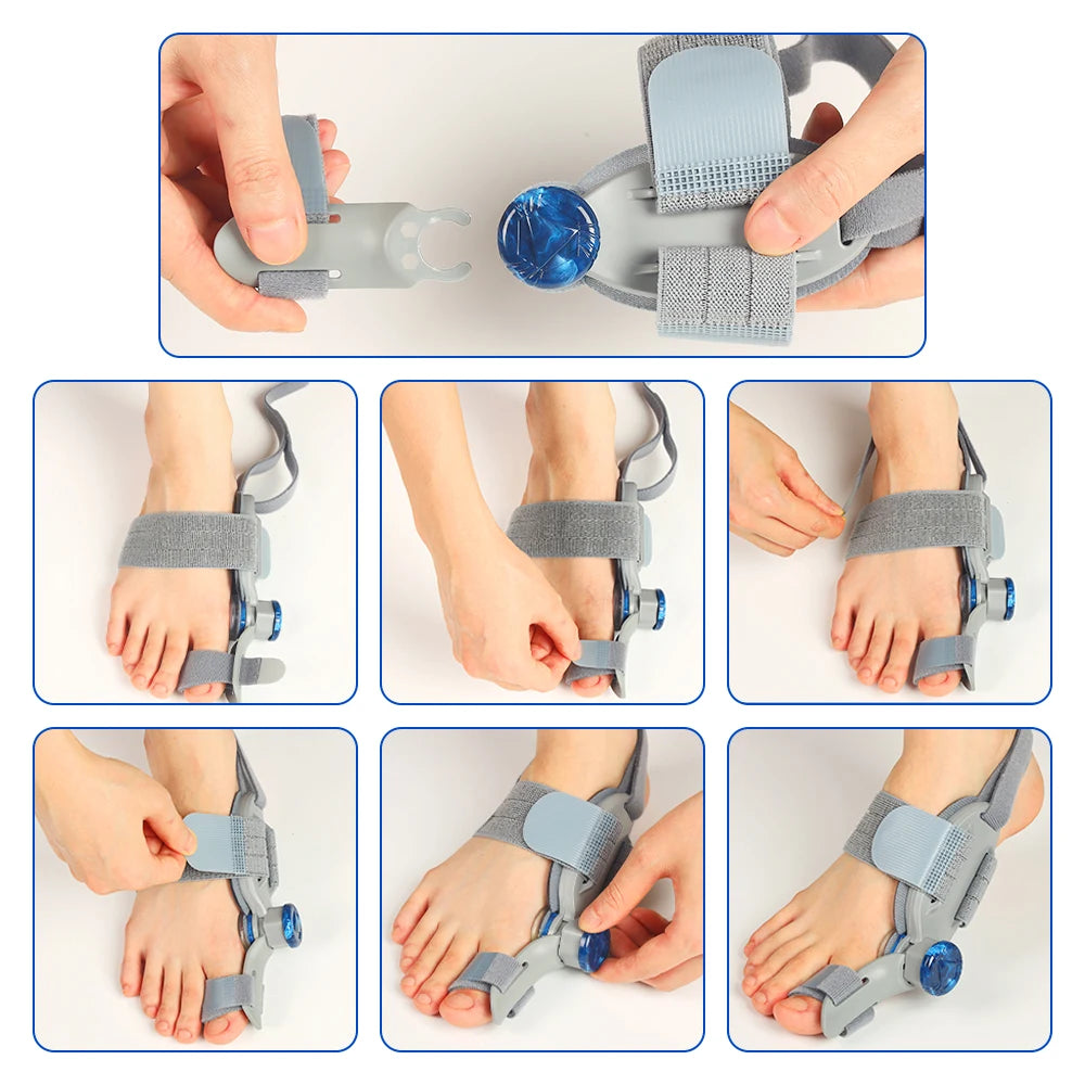 Adjustable Toe Separator & Bunion Splint – Rotatable