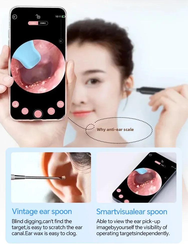 Wireless Otoscope Ear Cleaning Tool
